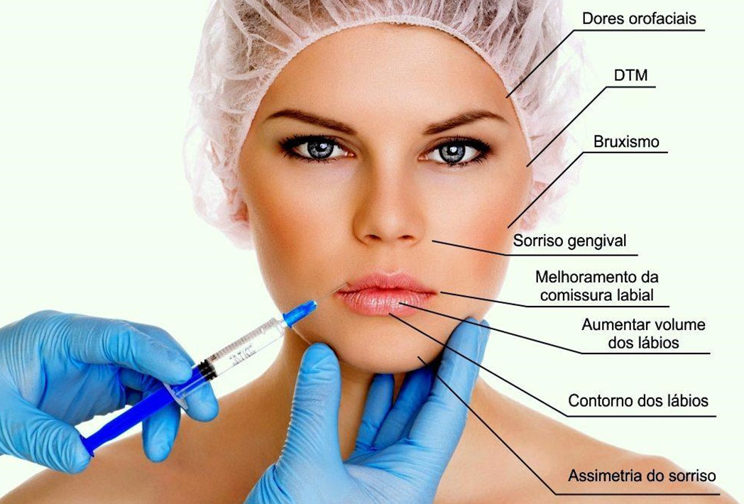 Aplicação de Botox